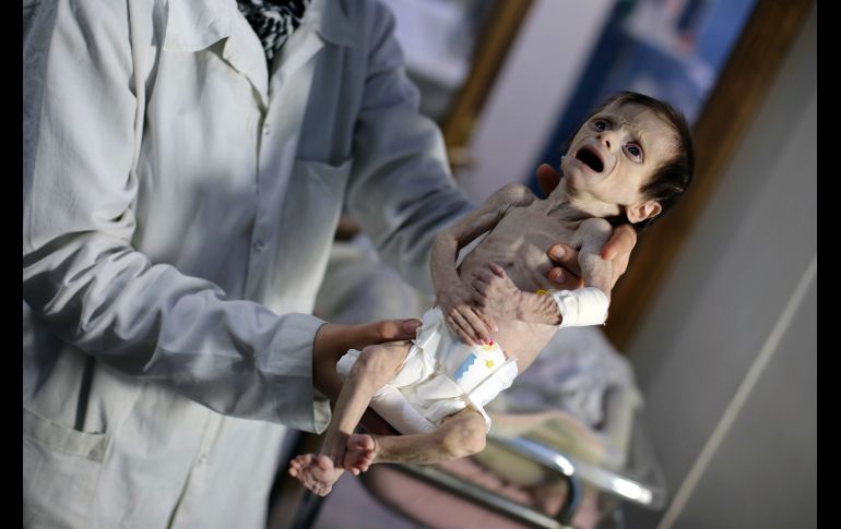 La menor intentaba llorar, pero no tenía la energía suficiente para hacer mucho ruido. AFP/A. Almohibany