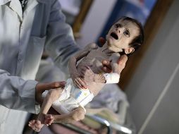 Otra cara de la guerra en Siria: Niños mueren de hambre