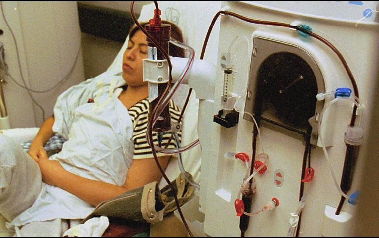 En 2013 se realizaron dos mil 707 trasplantes renales, cuando la lista de espera oficial asciende a más de 12 mil pacientes. EL INFORMADOR / ARCHIVO