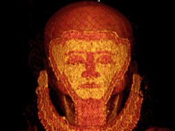 Las víctimas datan del año 2000 a.C. y 1800 a.C., respectivamente. ESPECIAL/ canal/UGR