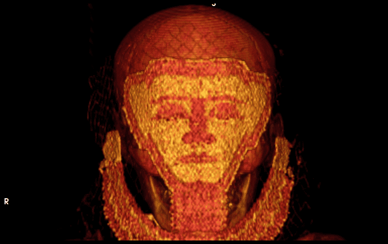 Las víctimas datan del año 2000 a.C. y 1800 a.C., respectivamente. ESPECIAL/ canal/UGR