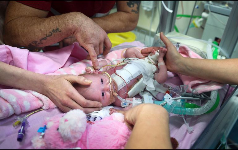 El hospital considera que Vanellope afronta aún un largo camino por delante, en el que el riesgo principal son las posibles infecciones. AP / B. Birchall