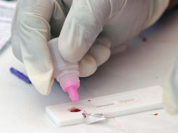 Los productos sanitarios para autodiagnóstico del VIH no han estado disponibles en el mercado europeo hasta fechas recientes. NTX / ARCHIVO