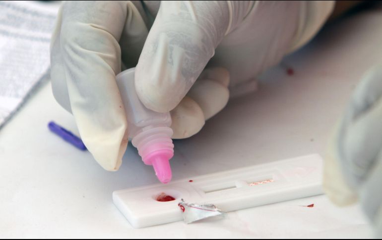 Los productos sanitarios para autodiagnóstico del VIH no han estado disponibles en el mercado europeo hasta fechas recientes. NTX / ARCHIVO