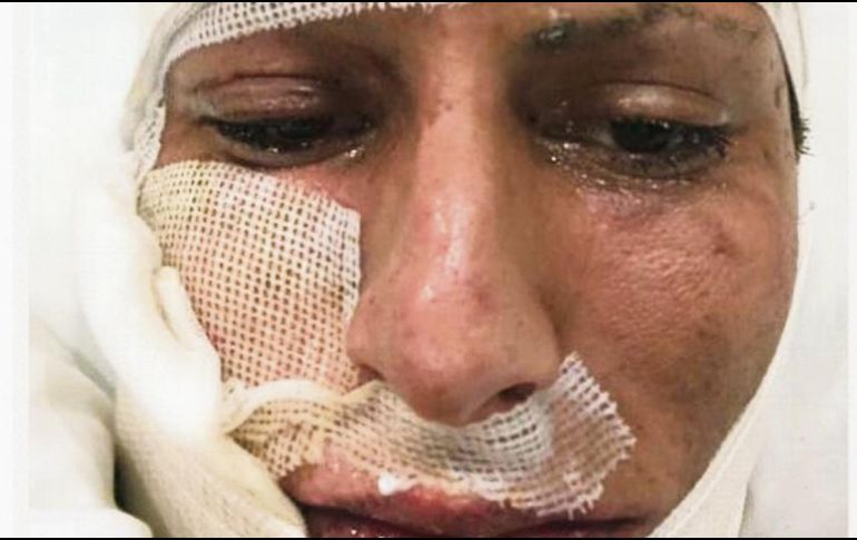 Jurgen Damm, de Tigres, estará dos semanas en recuperación luego de sufrir un accidente con fuegos artificiales. ESPECIAL