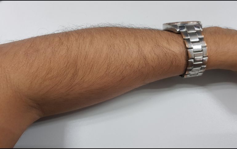 El escalofrío se manifiesta como una especie de hormigueo que recorre el cuerpo, pone la 