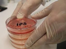 El estudio se basa en el uso células madre pluripotenciales inducidas (iPS), es decir, células adultas. ESPECIAL/ARCHIVO