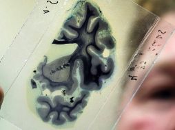 Más de 36 millones de personas en todo el mundo sufren demencia, de los cuales la mayoría padece la enfermedad de Alzheimer. EFE/ ARCHIVO