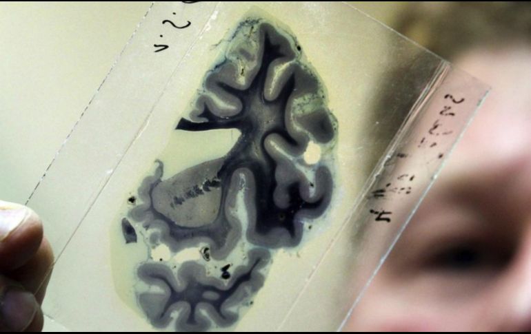En caso de que la zona cerebral donde se alberga esta función resulte dañada, la persona puede perder la capacidad de distinguir la realidad, el pasado y el presente, sin darse cuenta. EFE / ARCHIVO