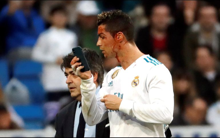 Usó un teléfono móvil como espejo para revisar el estado de su rostro. EFE/J. C. Hidalgo