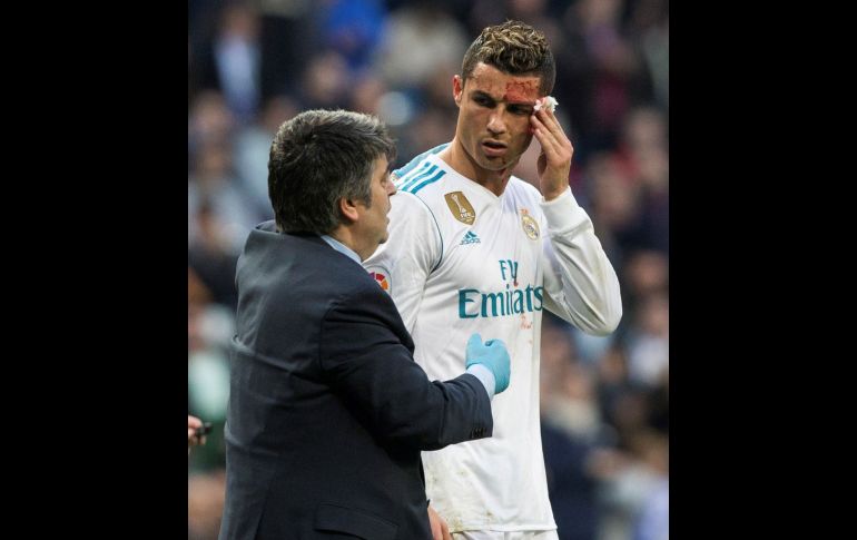 Con la cara ensangrentada, el portugués se retiró de la cancha. EFE/R. Jiménez