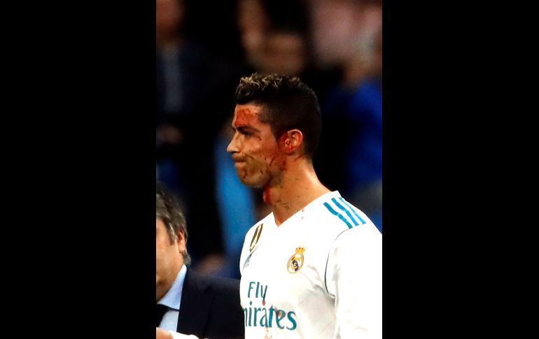 El delantero recibió dos o tres puntos de sutura, según dijo más tarde el entrenador Zinedine Zidane. EFE/J. C. Hidalgo