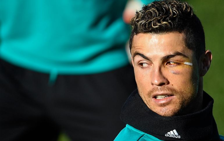 El portugués Cristiano Ronaldo asistió al entrenamiento del Real Madrid en la capital española con una tira de protección sobre los puntos que recibió en una herida, tras la patada sufrida el fin de semana en juego ante el Deportivo Coruña. AFP/O. Del Pozo