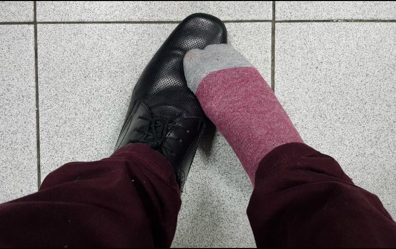 En ocasiones, a la par de la atención del juanete, también se tratan otros problemas, como apoyo inadecuado del pie y en tal caso, se prescribe el uso de una plantilla y zapato correctos. EL INFORMADOR