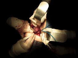 La ley dice que las personas recibirán dos cartas en las que se les preguntará si quieren ser donantes o no. EL INFORMADOR/F. Atilano