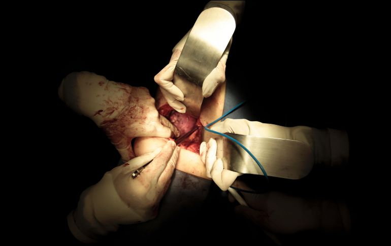 La ley dice que las personas recibirán dos cartas en las que se les preguntará si quieren ser donantes o no. EL INFORMADOR/F. Atilano