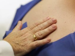 Los lunares se clasifican de acuerdo a su aspecto con las características observadas al microscopio y su origen. AFP / ARCHIVO