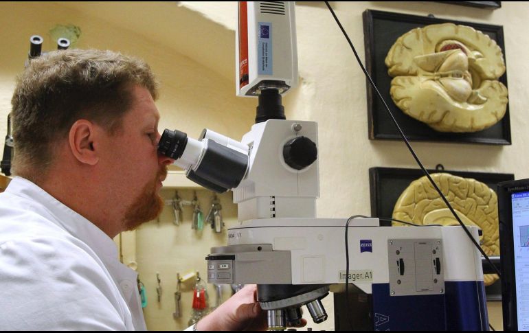 En el estudio, los autores analizaron células precursoras neuronales y neuronas inmaduras de 59 muestras de tejido cerebral humano. EFE/ ARCHIVO