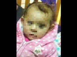 Debido a las condiciones y al consumo de droga por parte de sus padres, la niña quedó bajo la custodia del sistema de DIF de Ensenada. FACEBOOK / pgjebcmx