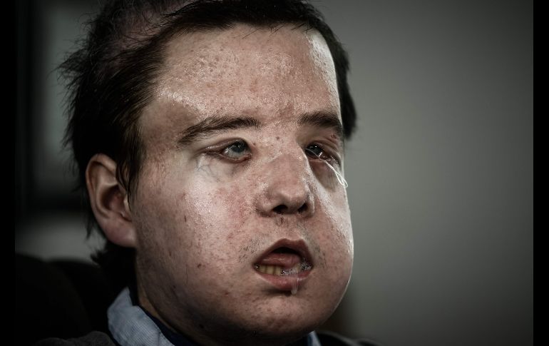 Hamon, de 43 años, posa en el hospital parisino Georges-Pompidou el pasado 13 de abril. AFP/P. Lopez