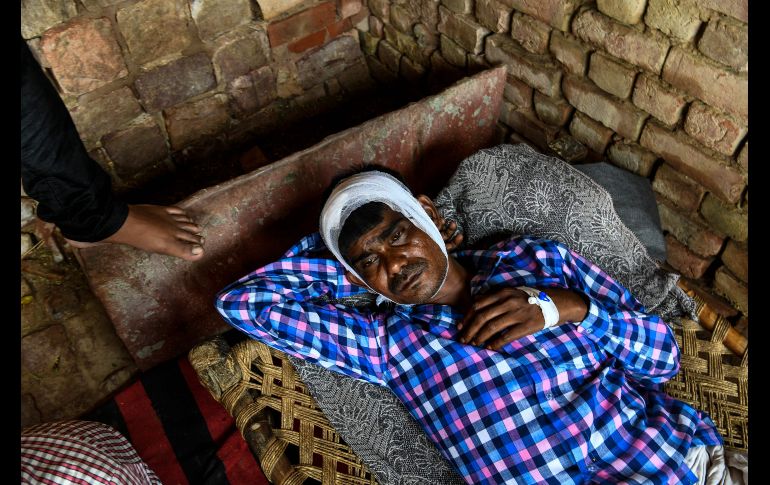 Dharamveer Singh, de 36 años, se recupera en su casa, la cual resultó dañada por las fuertes tormentas en Kheragarh, India. Los fenómenos meteorológicos esta semana han dejado 143 muertos. AFP/C. Khanna