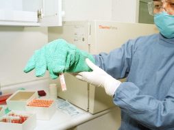 Las células son colocadas como un sustituto dérmico, lo que produce tejido y abona a una cicatrización de mejor calidad, algo que puede ser de gran utilidad en casos de quemaduras. NTX/ARCHIVO