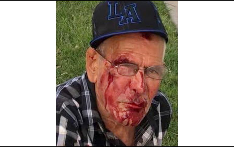 Rodríguez -que vive en México aunque tiene permiso de residencia permanente de Estados Unidos- estuvo hospitalizado. AP / Misbel Borjas