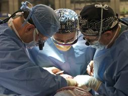 Para la cirugía cuentan con dos equipos multidisciplinarios de médicos, personas de enfermería y técnico que efectúan la cirugía de extracción y el implante. EFE / ARCHIVO