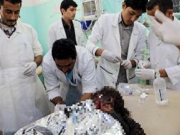 Médicos le brindan los primeros auxilios a una niña que resultó severamente lesionada tras las explosiones. AFP/STRINGER