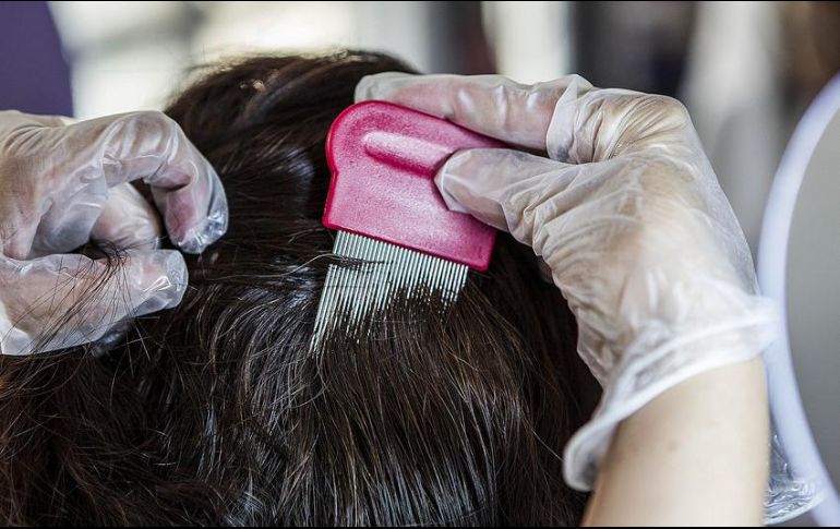 La época de los piojos suele empezar en octubre y sigue hasta la temporada de calor. La SSJ recomienda promover el baño diario o lo más frecuente posible. EL INFORMADOR / ARCHIVO