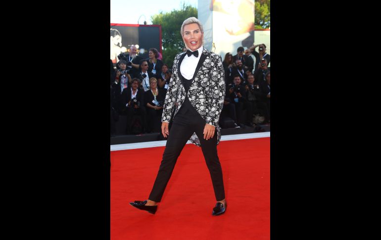 El hombre de 35 años se ha sometido a más de 50 cirugías.