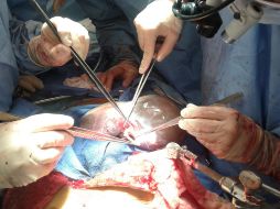 El Gobierno estima que la inscripción automática aumente la cifra de donantes desde los 25 mil voluntarios actuales a aproximadamente cuatro millones. EFE/Archivo