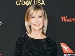 La actriz, con la mejor actitud para recuperarse de la enfermedad. AP