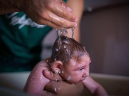 Entre las causas primordiales de la microcefalia figuran las infecciones y algunos virus incluyendo el Zika, así como otros factores como la ingesta de alcohol y drogas por parte de la madre durante el embarazo. EFE / ARCHIVO