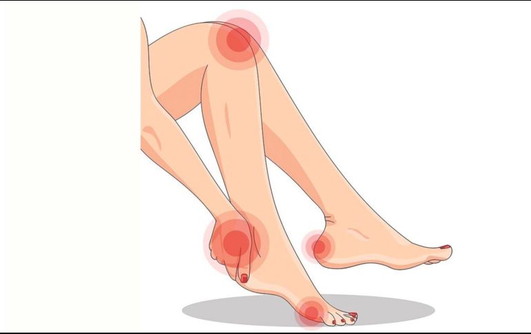 El SPC puede aparecer o empeorar durante el embarazo y es más común en personas con condiciones como: artritis reumatoide, diabetes o anemia. ESPECIAL / Pixabay