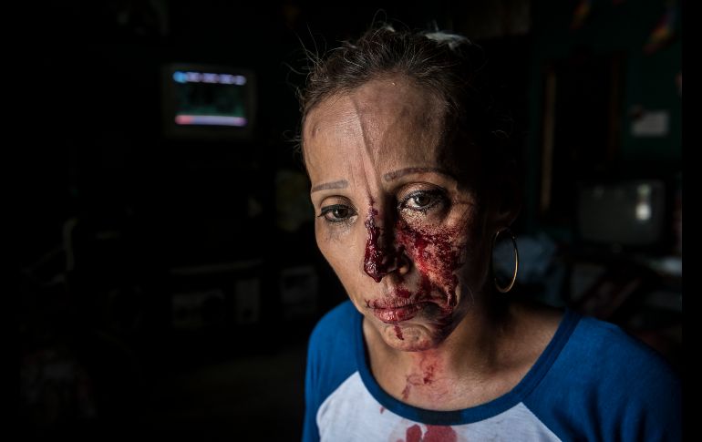 Una mujer se resguarda en una casa luego de ser golpeada cuando policías disolvían la manifestación en Managua. AP/O. Navarrete