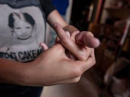 Las enfermedades reumáticas son la primera causa de incapacidad permanente y la segunda de incapacidad aguda. EL INFORMADOR / ARCHIVO