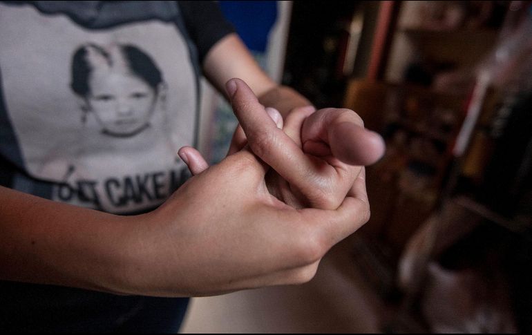 Las enfermedades reumáticas son la primera causa de incapacidad permanente y la segunda de incapacidad aguda. EL INFORMADOR / ARCHIVO