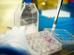 Hasta ahora, el trasplante de células madre se recomienda exclusivamente para tratar enfermedades hematológicas graves. ESPECIAL / irsicaixa.e