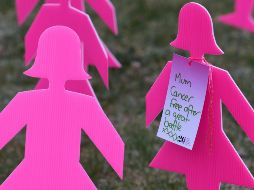 Este tipo de cáncer también puede provocar cambios en la piel del seno, en el pezón o en la areola; un sarpullido en la piel de apariencia similar a la mastitis, o infección del tejido mamario. EFE / L. Coch