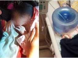 Sobre los hechos ocurridos el 11 de febrero, explican que se tuvo que improvisar para salvaguardar la vida de la menor, ya que los equipos con los que se cuentan estaban en uso en ese momento. TWITTER / @El_Universal_Mx