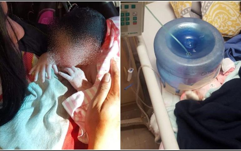 Sobre los hechos ocurridos el 11 de febrero, explican que se tuvo que improvisar para salvaguardar la vida de la menor, ya que los equipos con los que se cuentan estaban en uso en ese momento. TWITTER / @El_Universal_Mx