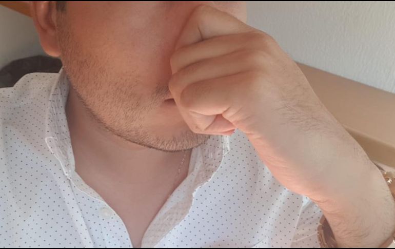 Los cuatro síntomas característicos de ka rinitis alérgica son moco, estornudo, comezón y obstrucción nasal; en las reacciones alérgicas puede haber también dolor abdominal, tos, ansiedad, diarrea, dificultad para deglutir, mareo o vértigo. EL INFORMADOR