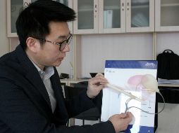 El doctor Tian Long, del Hospital de Chaoyang, dice que una evaluación psicológica es fundamental para determinar si es o no necesaria una operación de estas características. EFE/J. Castro