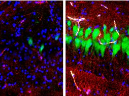 Según, Nenad Sestan, investigador de la universidad de Yale, estos trabajos demuestran que 