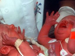 Los dos gemelos no tendrán legalmente la misma edad, lo que no dejó de provocar perplejidad en los servicios administrativos. EFE/ARCHIVO