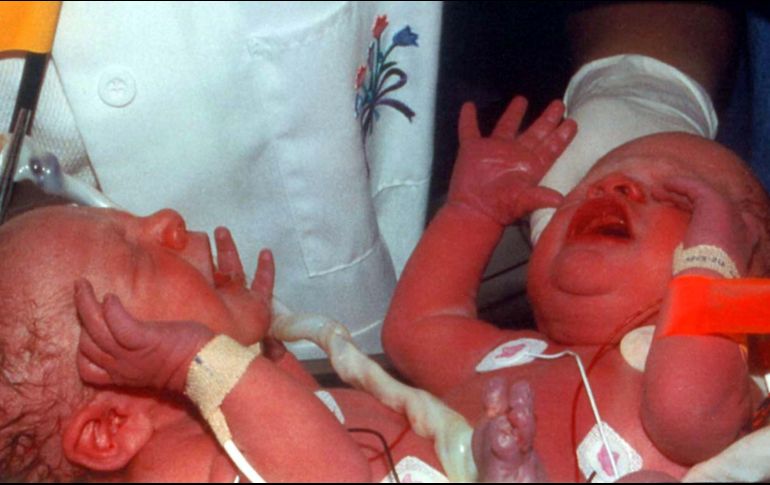 Los dos gemelos no tendrán legalmente la misma edad, lo que no dejó de provocar perplejidad en los servicios administrativos. EFE/ARCHIVO