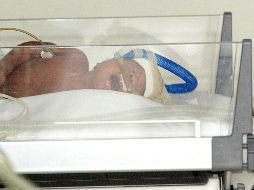 No se ha especificado a que se debe el brote de la bacteria. ARCHIVO / EL INFORMADOR