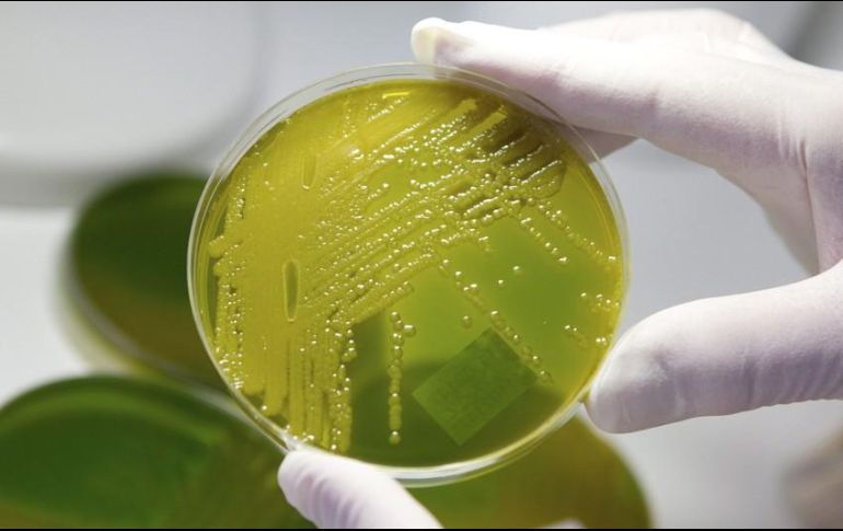 El director del nosocomio dice que el problema se vuelve un desafío cuando esta bacteria presenta resistencia a los antibióticos más potentes y entonces es un verdadero reto, incluso pone en peligro a los pacientes. EFE / ARCHIVO