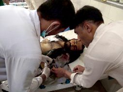 Se reporta que el objetivo era Hajji Turkhan, comandante de una milicia local que combate a la insurgencia, quien está entre los fallecidos. EFE / G. Habibi